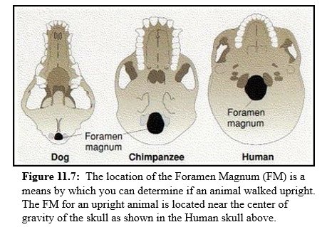 The location of the Foramen Magnum